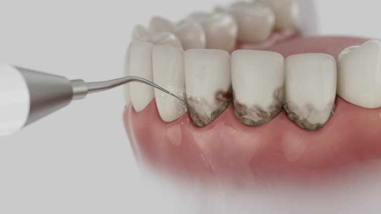 Trusted Teeth Cleaning And Checkup service in Valley Forge, TN - Dentist Open Now